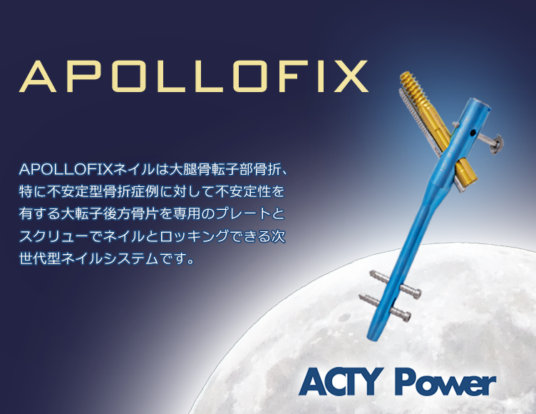 apollofix