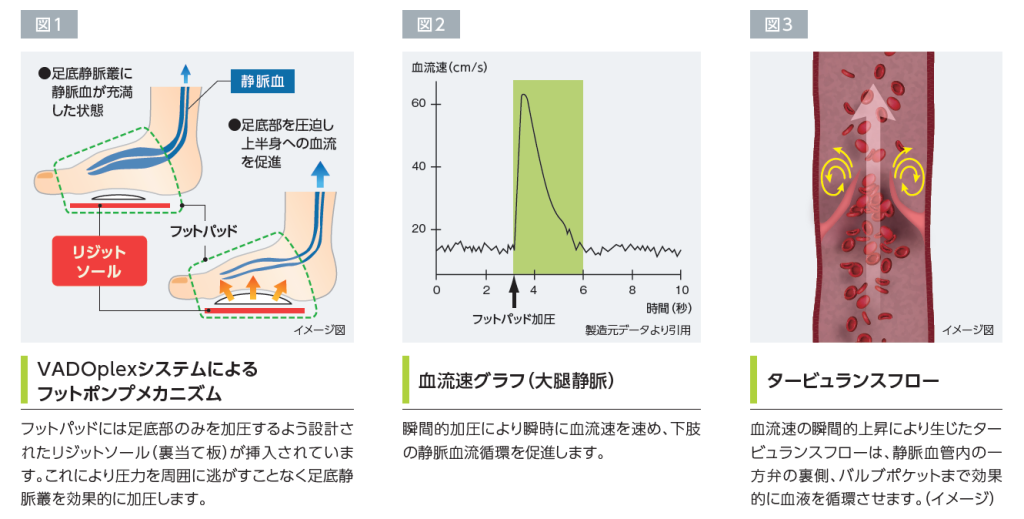 VADOplexシステム | 製品情報 | エム・シー・メディカル株式会社